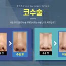 보아스이빈후과 네이버블로그