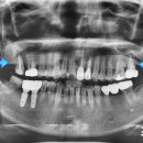 고운가이드치과병원 이미지