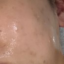 엠제이시스템 | 대림역피부관리 '엠제이뷰티' 에어젝션 리프팅 물광 재생관리 받은 후기