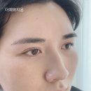 지윤헤어라인