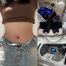 더맑은한의원 | 강남다이어트내성 극복기: 서초다이어트한의원 교대다이어트약침 + 산소챔버 정체기 탈출