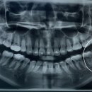 수성사랑니치과의원 이미지