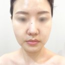 활짝열린의원 | 신장동 피부관리 결담은 피부 연구소 수분관리 하나로 피부톤이 달라졌어요!