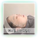 예스병원 | 예스필 후기 민감피부 관리 받으니까 화장 잘 먹음