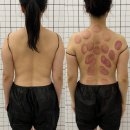 김포한강2로 104번길 | 김포체형관리 ⭐김포뷰티온 1회 관리 후 놀라운 변화!