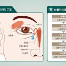 새봄안과 이미지