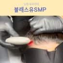 [노원두피관리]블래스유SMP에서 모발성장술 받은 후기