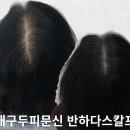 대구SMP