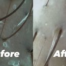 329 | 평택 헤드스파 크리시모 by 뷰티329 방문 후기 : 탈모 고민 해결하고 온 힐링 타임 (가오픈 1+1이벤트 중!)