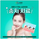 스타교정치과기공소 이미지