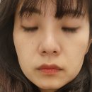 본태의원 네이버블로그