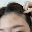[부천]부천왁싱 전문 다나왁싱앤뷰티 자연스러운 이마+헤어라인 후기
