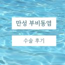 청이비인후과 | [부산이비인후과] 만성부비동염: (2) 수술 후기 (내 인생 첫 수술 ..)