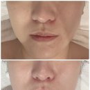 센타프라자(안양센타빌딩) | 안양범계신부관리 유명한 범계피부관리 씨엘오비스 상세후기