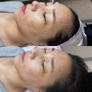 휴먼시아약국 | [수완지구피부관리] 세이뷰티 실제 모공클리닉 후기와 자세한 변화 기록