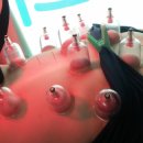 구침한의원 네이버블로그