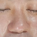 포항시북구10 | 포항피부관리 전문점 포항북구 두호동 새미모 포항점 남성 슉클리어 후기