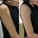 바디리핏 | 영등포 지방분해주사, 올리핏으로 여름 맞이한 내돈내산 후기(도움의원)
