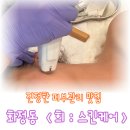 당일 바로 효과 본 희스킨케어 피부숍에서 노블젝션 엑소좀관리