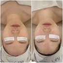남포동루미에르 | 방문 후기 : 남포동 루미에르 관리 후기 / 남포동 여드름, 남포동 미백관리, 남포동 피부관리 추천