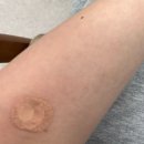 효원약국 | 🤧선원용 건강검진 후기🏥