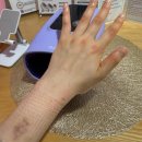 코끼리밀면 | 목동 라테라 산후조리원 마사지 후기(코끼리 다리에서 탈출하자, 이 부종을 갖고 나갈 수는 없어)