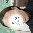 내돈내산 닥터에버스의원 LDM(12분) + 모델링팩 후기