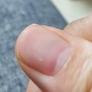 하얀손톱