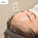 스타메디타워 | 센텀시티역 피부과, 이마필러 잘하는곳은 어떻게 시술할까? <10년차 대표원장 작성>