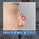 혹부리한의원 이미지