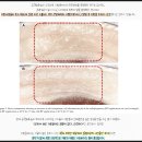 (주)해마글로벌 | [위례 리프팅] 울쎄라만 답은 아닙니다｜얼굴살 많은 타입에서 온다(Onda) 리프팅이 갖는 장점