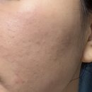 메디힐케어 | 예신이라면 수분 흔적 케어!! 메디힐 수분흔적세럼 후기