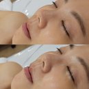 레몬부분정비 | 부산남천동피부관리 레몬트리에스테틱 (톡톡모공샤워, 탈리온제품)