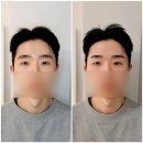 논현종합인테리어 | 강남 남자눈썹정리 리얼페이스 신논현 후기, 자연스럽게 채운 콤보눈썹 차이비교