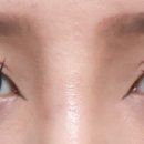 올리팅성형외과의원 이미지