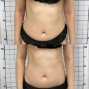 메리미에스테틱 | 안산웨딩케어 메리미뷰티 예쁜드레스핏의 핵심 에너지테라피로 승모근관리와 바디슬리밍관리 솔직후기