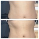 숲칼프교육전문센터원주점 | 원주다이어트 찾는다면? 원주 숲칼프교육전문센터 에너지테라피 + 온열돔 관리 후기