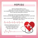 질병 "부정맥 arrhythmia" 이미지