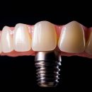 일산웰치과의원 이미지