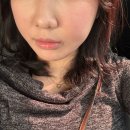 광재1 | 수원 인계동 실리프팅 솔직후기 | 심부볼 실리프팅 완전 만족 대 강추 후기