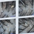 네온컴 | 인천 구월동 두피관리 전문 #모바이오 인천구월본점 | 1:1퍼스널맞춤케어 문제성 두피 스케일링 후기