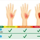 화상2 네이버블로그