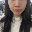 찐추 | 웨딩관리 결이고은 분당점, 스페셜 작은얼굴관리 받고 찐추 후기