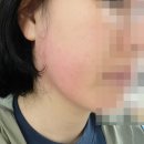 우리메디 | 메디제이 더블유크림 라이트 사용후기