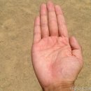 용인피부과 서울나온피부과의원 여기서 피부를 되찾자