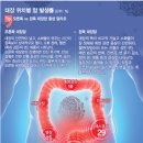 이럴 땐 '대장암' 의심해야…대변이 보내는 위험 신호 5가지 이미지