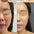 찌니네일