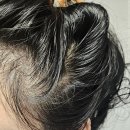 채울 | 두피염 두피냄새 고민 약산성 포셰리 채울 샴푸 후기