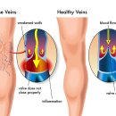 라인건강약국 이미지