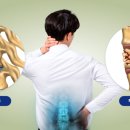 일광보조기 이미지